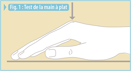 Schéma du test de la main à plat pour la maladie de Dupuytren